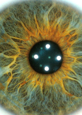 Iridology